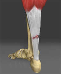 Foot & Ankle Image Foot & Ankle
