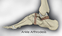 Foot & Ankle Image Foot & Ankle