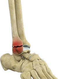 Knee Image Knee