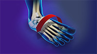 Foot & Ankle Image Foot & Ankle