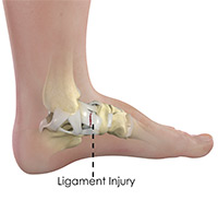 Foot & Ankle Image Foot & Ankle
