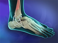 Foot & Ankle Image Foot & Ankle