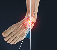 Foot & Ankle Image Foot & Ankle