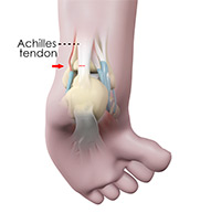 Foot & Ankle Image Foot & Ankle