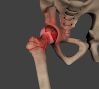Hip Image Hip