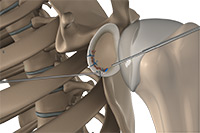 Shoulder and Elbow Image Shoulder and Elbow
