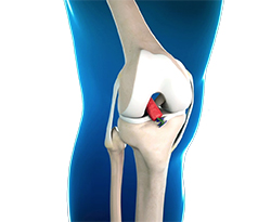 Shoulder and Elbow Image Shoulder and Elbow