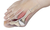Foot & Ankle Image Foot & Ankle