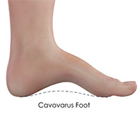 Foot & Ankle Image Foot & Ankle
