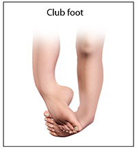 Foot & Ankle