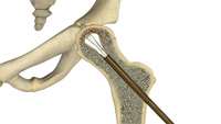 Hip Image Hip