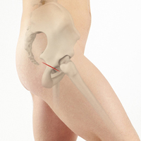 Direct Superior Hip Replacement
