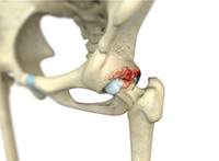 Hip Image Hip