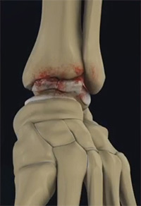 Foot & Ankle Image Foot & Ankle