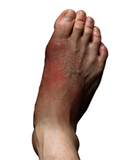 Foot & Ankle Image Foot & Ankle