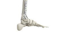 Foot & Ankle Image Foot & Ankle
