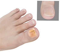 Foot & Ankle Image Foot & Ankle