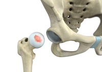 Hip Image Hip