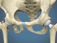 Hip Image Hip