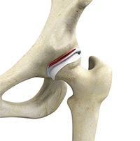 Hip Image Hip
