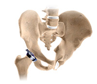 Hip Image Hip