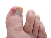 Foot & Ankle Image Foot & Ankle