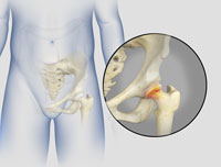 Hip Image Hip