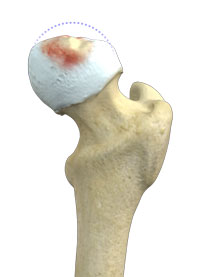 Hip Image Hip