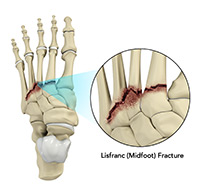 Foot & Ankle Image Foot & Ankle