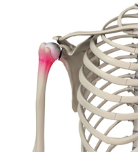 Little League Shoulder Image Little League Shoulder