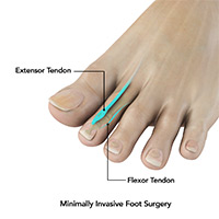 Foot & Ankle Image Foot & Ankle