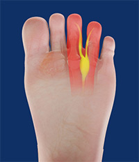 Foot & Ankle Image Foot & Ankle