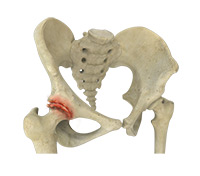 Hip Image Hip
