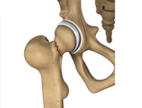 Hip Image Hip