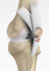 Knee Image Knee