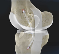 Knee Image Knee