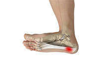 Foot & Ankle Image Foot & Ankle