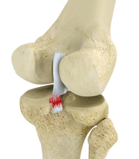 Knee Image Knee