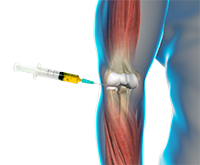Shoulder and Elbow Image Shoulder and Elbow