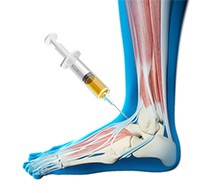 Foot and Ankle Image Foot and Ankle