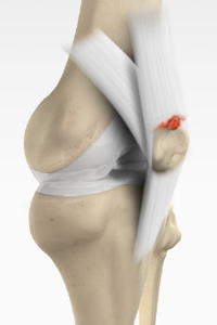 Knee Image Knee