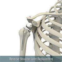 Shoulder and Elbow Image Shoulder and Elbow