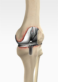 Knee Image Knee
