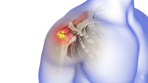 Shoulder and Elbow Image Shoulder and Elbow