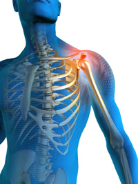 Shoulder Pain Image Shoulder Pain