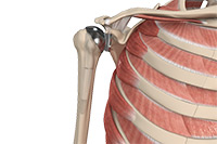 Shoulder and Elbow