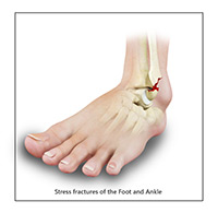 Foot & Ankle Image Foot & Ankle