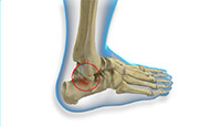 Foot & Ankle Image Foot & Ankle