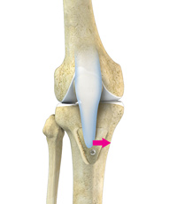 Knee Image Knee