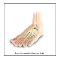 Foot & Ankle Image Foot & Ankle